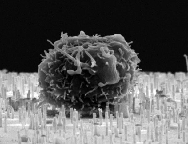 Electron microscopy image of hematopoietic stem/progenitor cell on top of nanostraws. Image credit: M. Hjort and L. Schmiderer