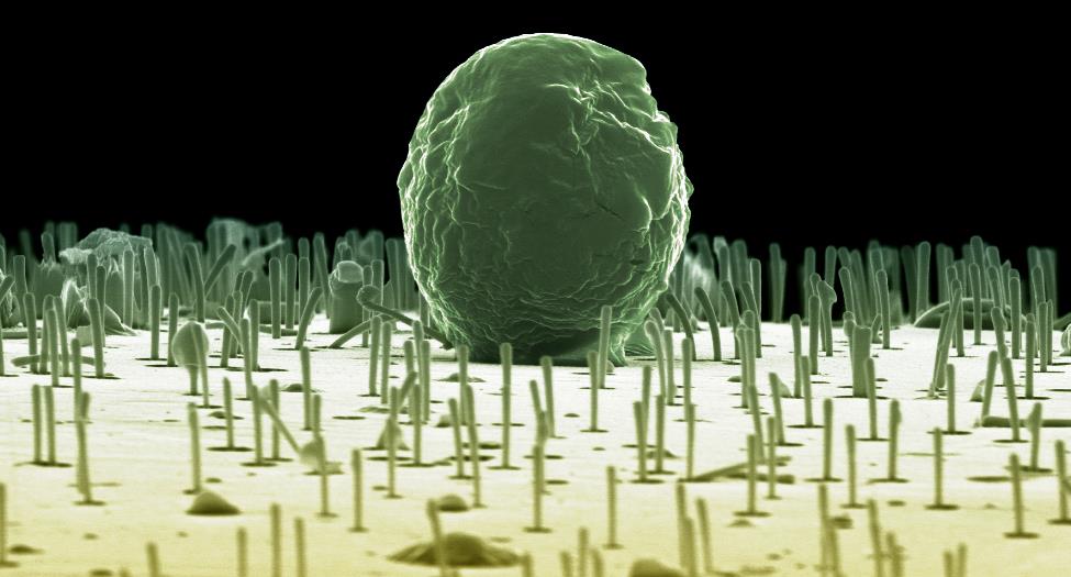 Microscope-photo of a cell on nanowires.